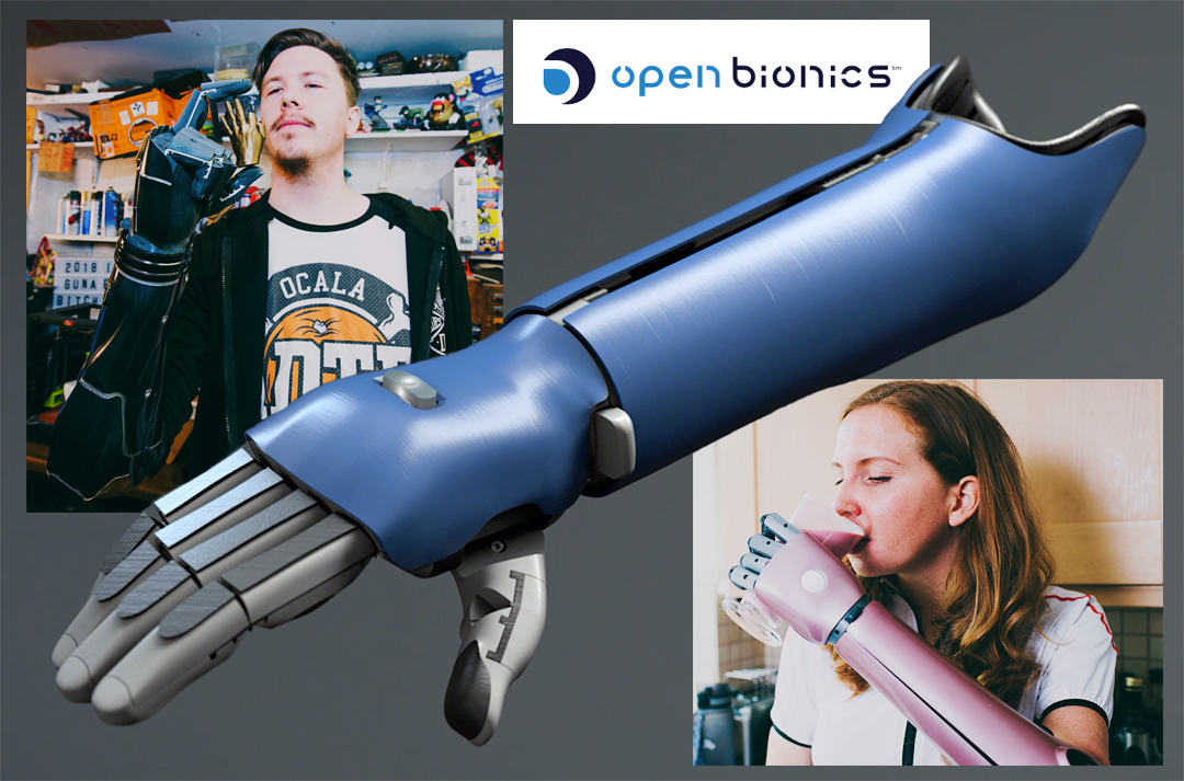 Open Bionics - Introducing Hero Arm | Closing The Gap